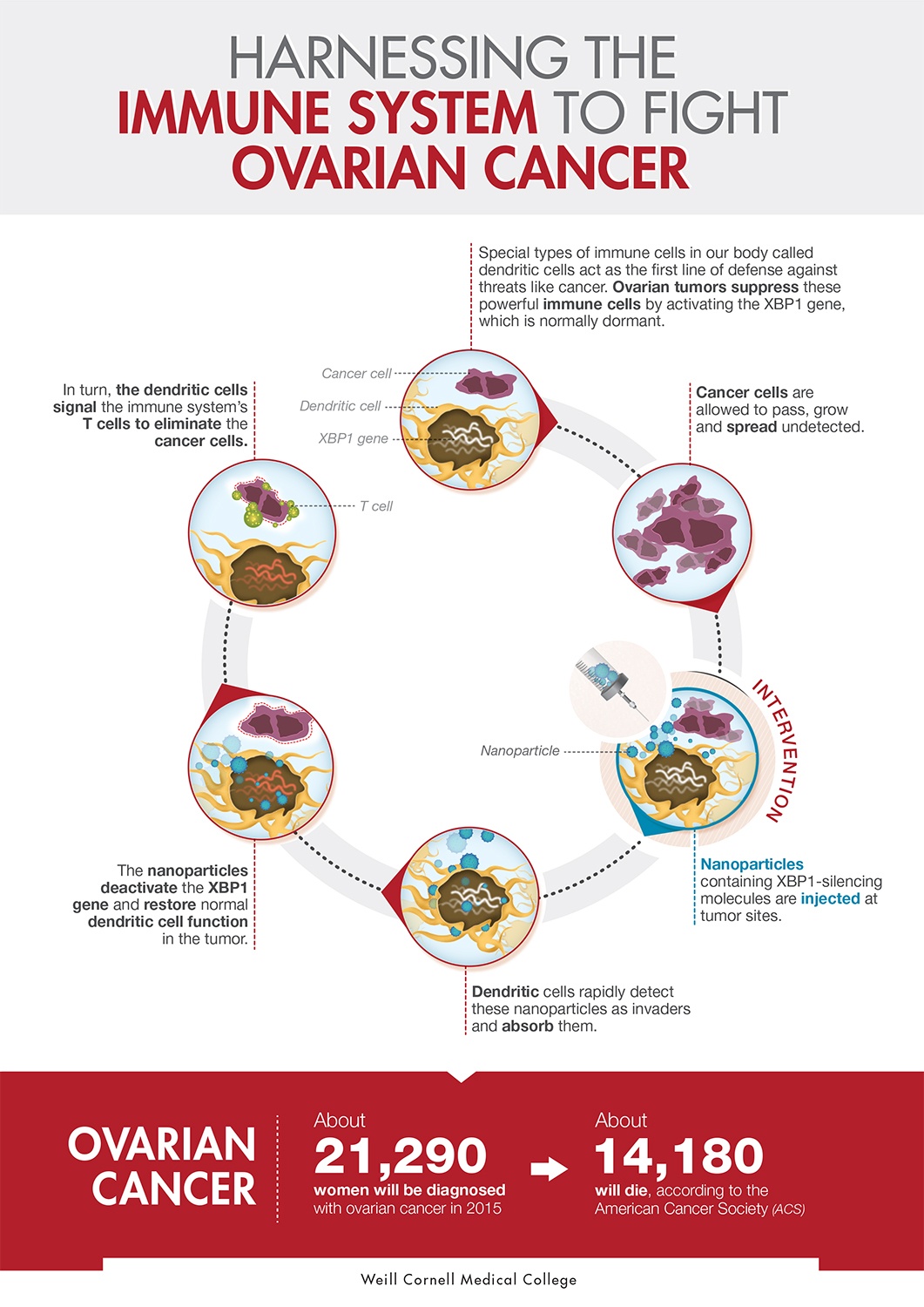 Infographic of ovarian cancer immune response