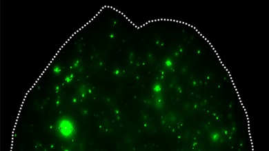 Exosomes, in green, are being investigated for their potential for diagnosing and treating cancer.