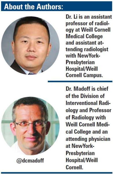 David Li, MD, PhD, and David C. Madoff, MD, FSIR, FACR