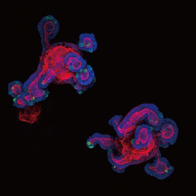 Mouse intestinal organoids that scientists genetically engineered to study colon cancer. Using gene editing technology, the investigators fused together the genes Ptprk and Rspo3 to determine their effect on cancer development.