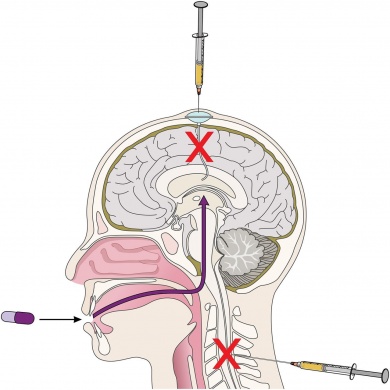 Different routes of CNS-directed therapies in MCL