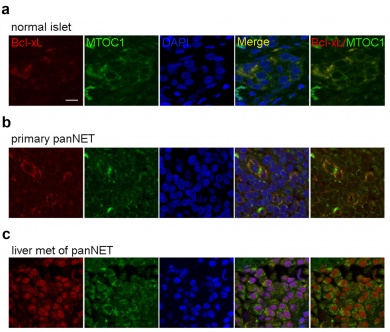 Images of protein Bcl-xL in the mitochondria