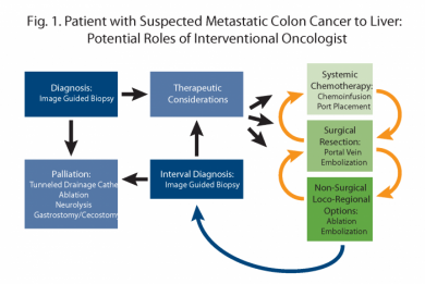 Interventional Oncology As The Fourth Pillar Of Cancer Care | Sandra ...