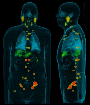 Molecular imaging 