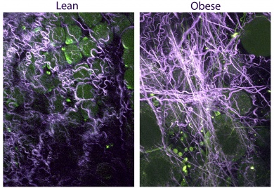 Collagen fibers in the breast tissues of mice