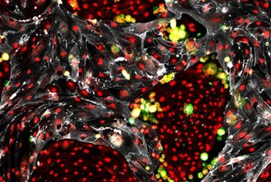 reprogrammed hematopoietic stem cells (green) that are arising from mouse cells