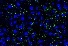 Tumor cell-derived EVPs induced accumulation of lipid droplets in the mouse liver. Green, lipid droplet. Blue, DAPI. Credit: Gang Wang, Jianlong Li, David Lyden.
