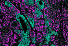 Immunofluorescence image of purple and green cells