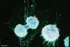 blue spherical objects against a black backdrop