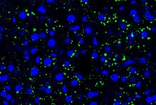 Tumor cell-derived EVPs induced accumulation of lipid droplets in the mouse liver. Green, lipid droplet. Blue, DAPI. Credit: Gang Wang, Jianlong Li, David Lyden.