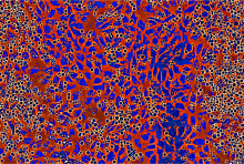 colorized greyscale image of blood cells expanding on top of vascular endothelial cells