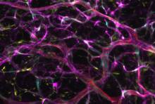 blood vessels from endothelial cells