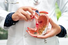 Doctor holding a diagram of the stomach