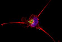 This image shows a triple-negative breast cancer cell undergoing cell death after treatment with a combination of chemotherapy and a second targeted drug. Actin in red; mitochondria in green; nuclei in blue. Credit: National Cancer Institute