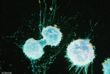 ovarian cancer cells