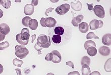 blood cells stained with Wright-Giemsa stain