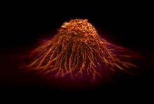 illustration of a brain tumor