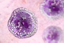 B-cell lymphoma 