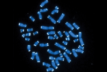 chromosomes with telomeres