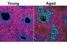 cells stained blue and purple