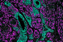 Immunofluorescence image of purple and green cells