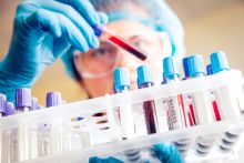 researcher holding a vial of blood over a rack of vials