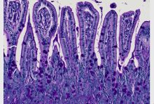 microscopic image of small bowel