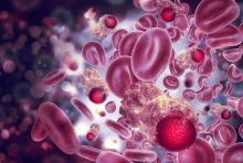 illustration of blood cancer