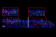 resident memory T cells