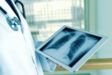 Radiologist examining a chest X-ray of a patient. Credit: Shutterstock