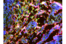 Immunofluorescence of a lymph node shows lymphatic endothelial cells contain the enzyme (labeled in green) that generates 3HKA. Image courtesy of Dr. Laura Santambrogio.